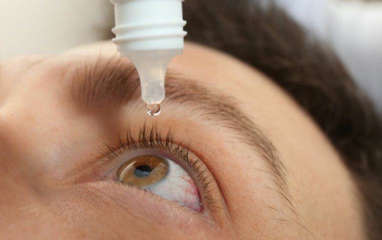 5 Best Eye Drops for Dry Eyes
