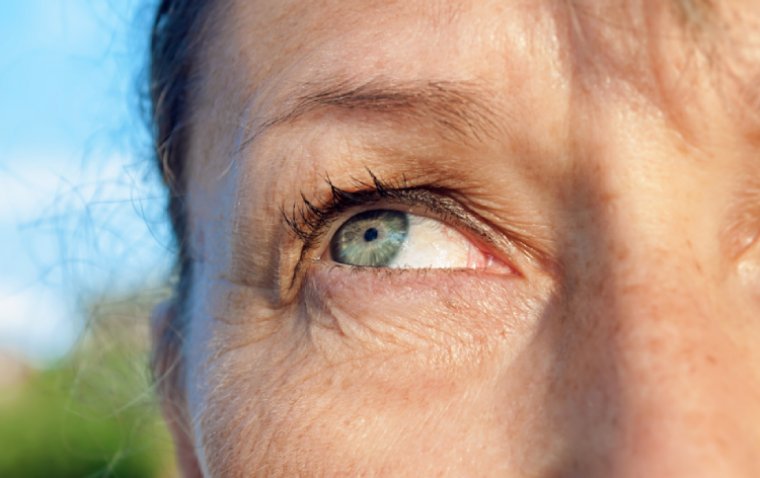 5 Foods to Avoid After Cataract Surgery for Optimal Recovery