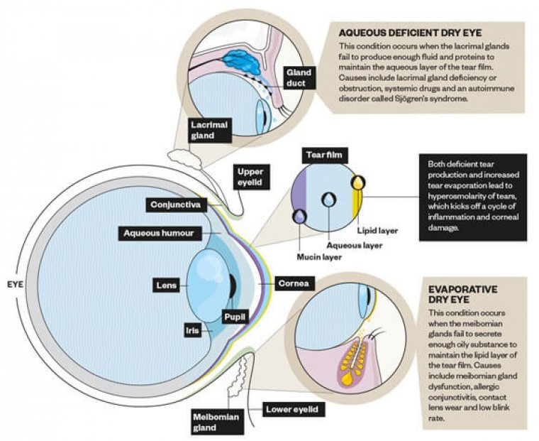 Dry Eye Symptoms Differences Between Day & Night