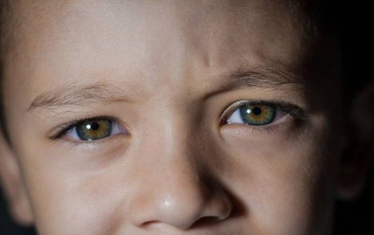 Early-Onset Atopic Dermatitis Linked to Increased Risk of Pediatric Uveitis