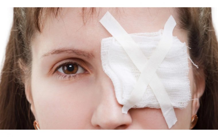 How to Heal Traumatic Eye Injuries: Tips and Techniques