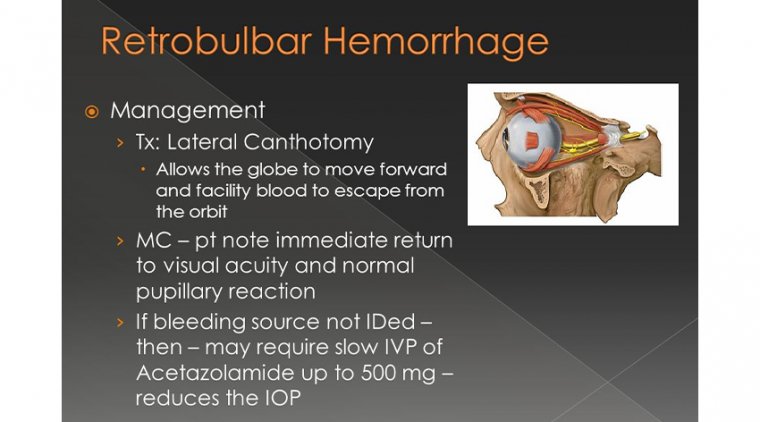 In Light Of Managing Retrobulbar Hemorrhage