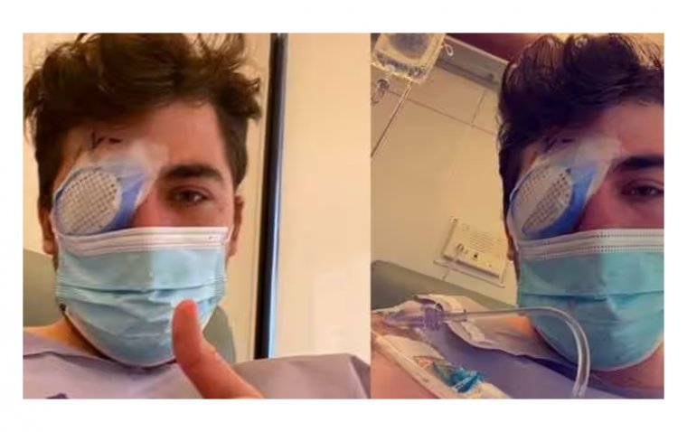 Man Loses Sight in One Eye After Sleeping in Lenses