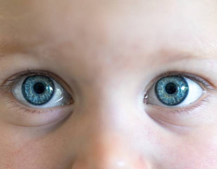 Microdrops Show Potential for Safer Retinopathy of Prematurity Screening in Preterm Infants