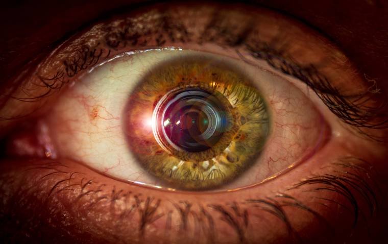 Mild Intraocular Inflammation More Frequent with Aflibercept 8 mg in Real-World Use, Study Finds