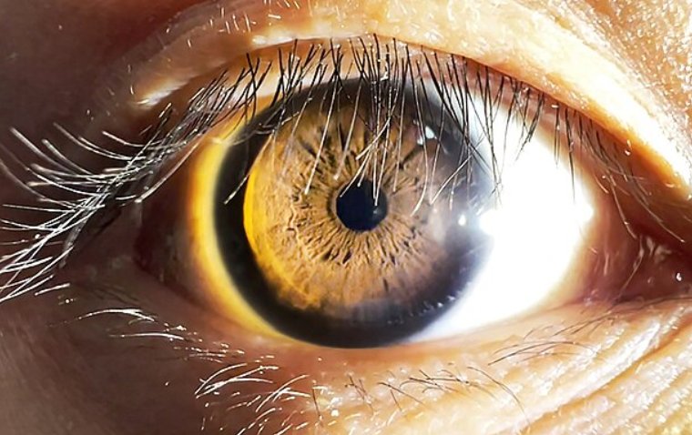 Pupil Size and the Brain: Exploring the Science of Miosis