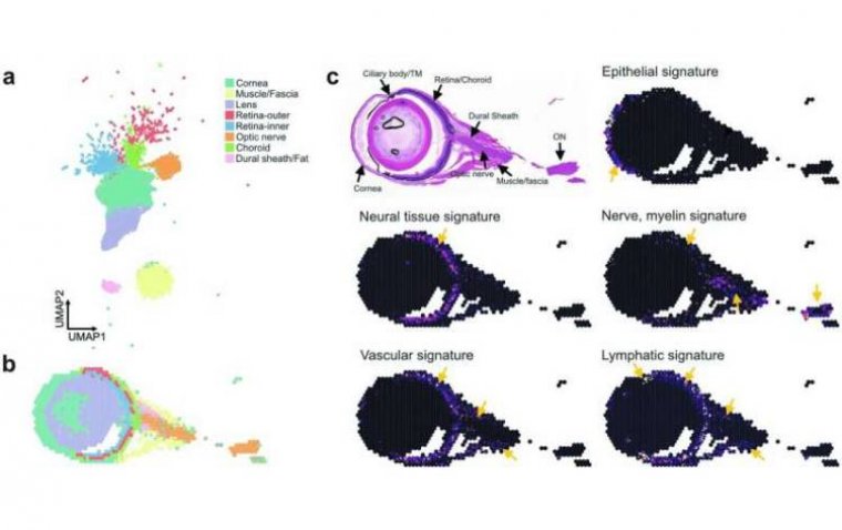 Study Reveals Eye's Surprising Defense Against Brain Infections