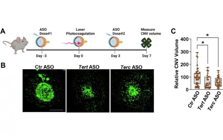 Study Suggests New Treatment Approach for Wet AMD