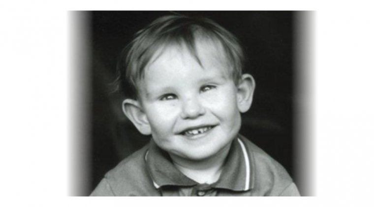 The Dark Side of Genetics: The Impact of Lowe Syndrome