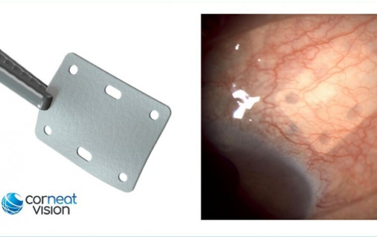 World’s First Synthetic, Non-Degradable Tissue