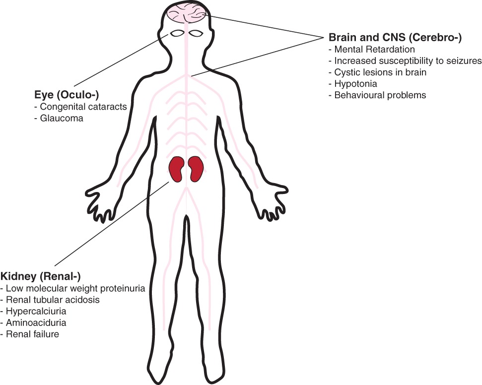The Cellular and Physiological Functions of the Lowe Syndrome Protein OCRL1 Credit: Wiley Online Library
